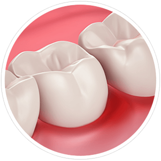 Gum Health and Sensitivity Gum Health and Sensitivity